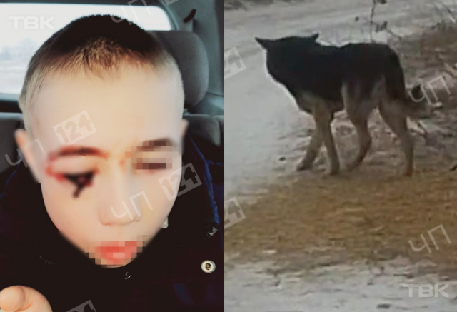 «Ждал родителей у школы»: в Канском районе бродячая собака разодрала лицо ребенку