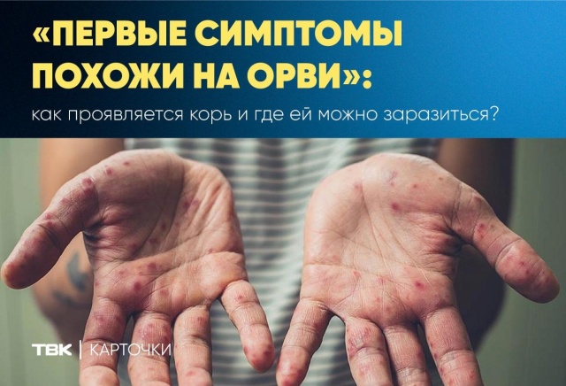 Как проявляется корь и чем она опасна 