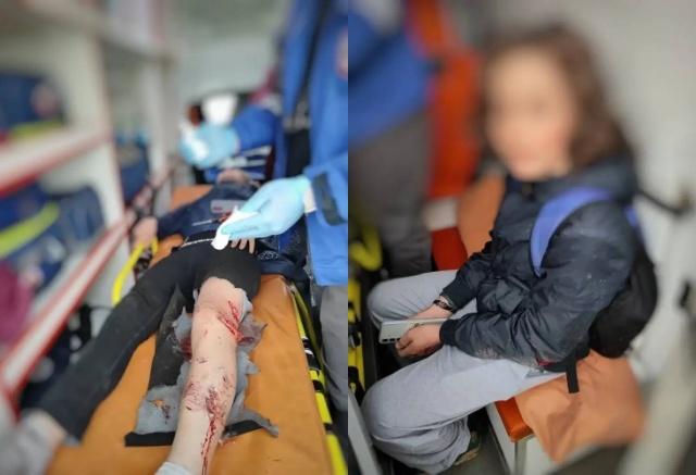Бродячие собаки напали на двоих детей в Норильске